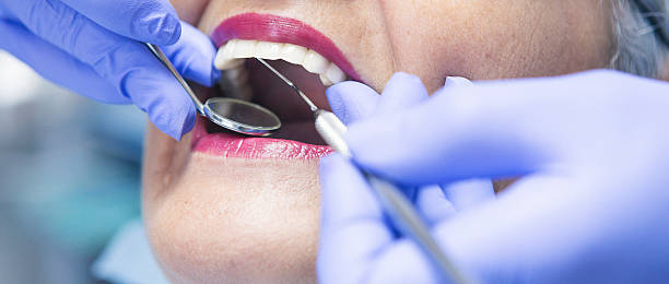 Best Emergency Root Canal Treatment in Poolesville, MD